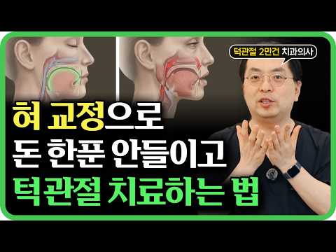 턱관절 치료, 비싼 돈 들이지 않고 ‘혀 위치’로 교정하는 방법 영상 썸네일