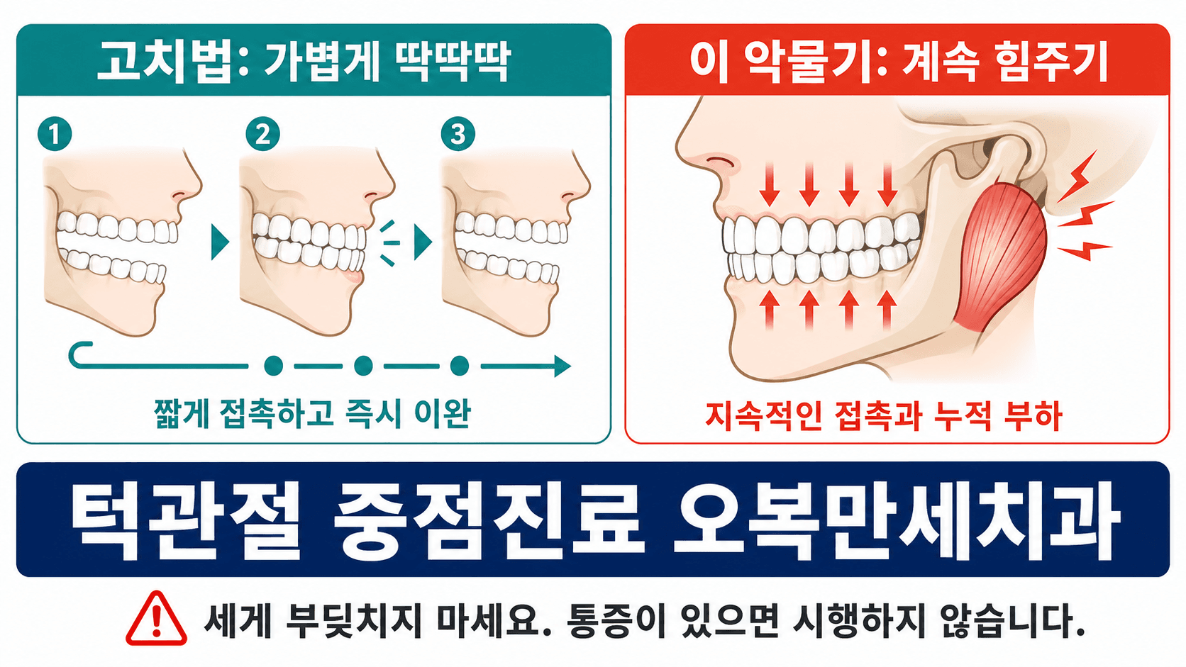 치아가 짧게 닿고 즉시 떨어지는 고치법과 치아를 맞댄 채 힘을 유지하는 이 악물기의 차이 도해