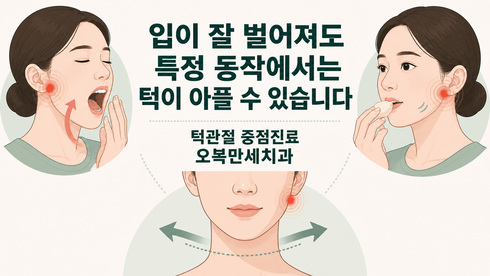 입은 벌어지지만 하품과 씹기 및 좌우 턱 움직임에서 턱관절 통증이 나타날 수 있음을 설명한 비실사 도해