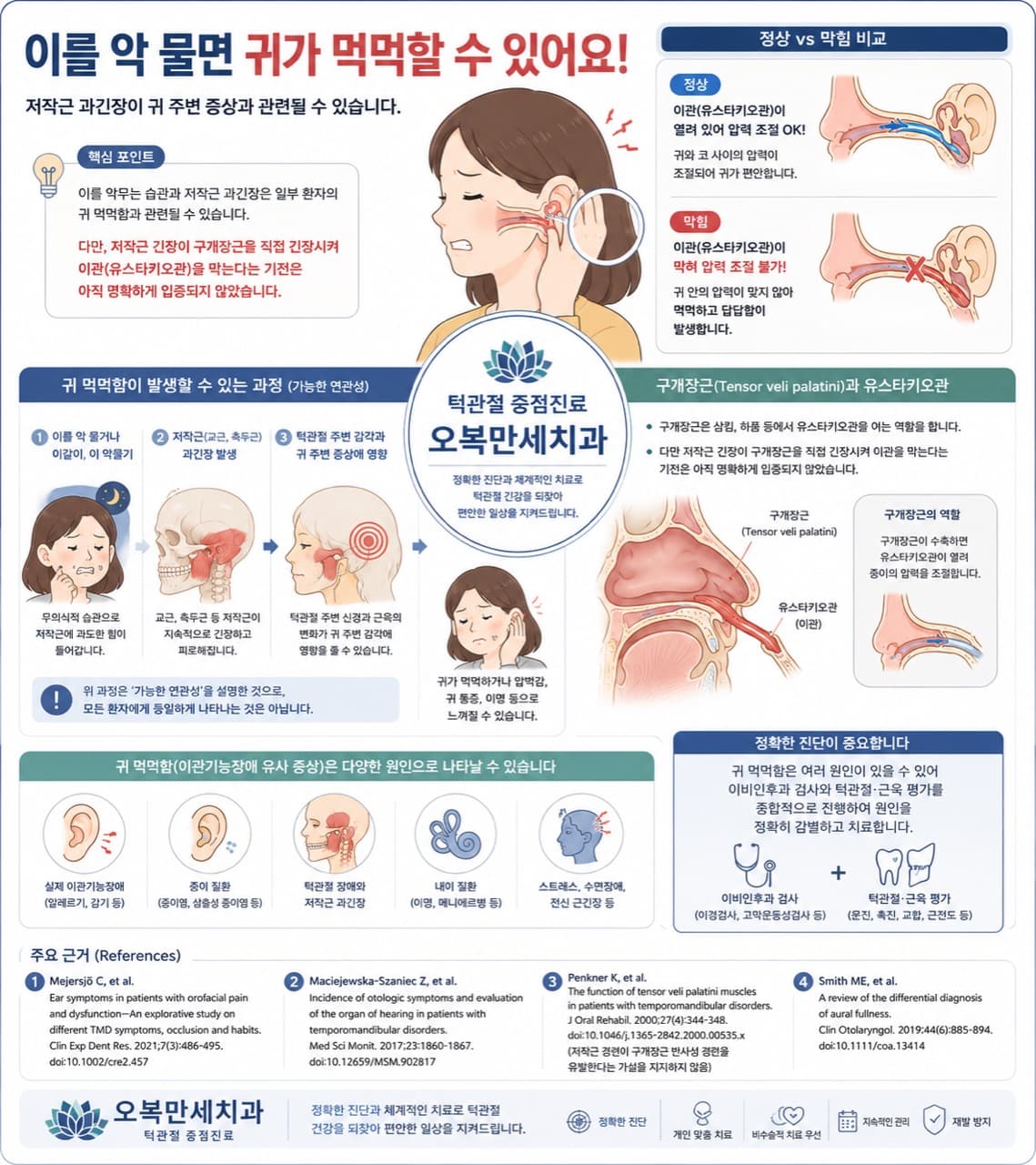 이를 악물 때 저작근 긴장과 턱관절 주변 부담이 일부 환자의 귀 먹먹함과 함께 나타날 수 있는 과정을 설명한 인포그래픽