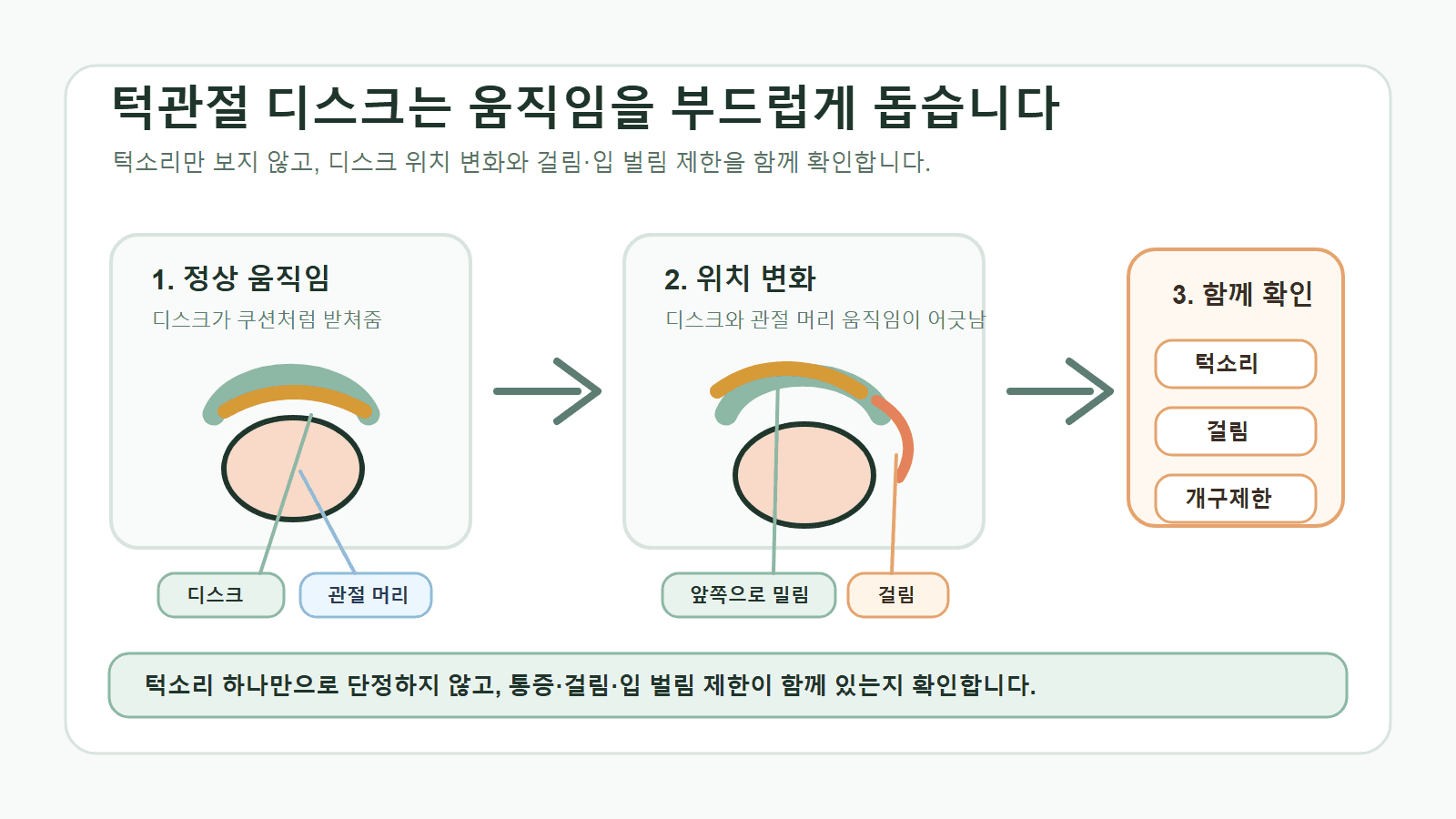 턱관절 디스크의 정상 위치와 변위를 비교하고 MRI 소견만으로 수술 여부를 결정하지 않는다는 설명 그림