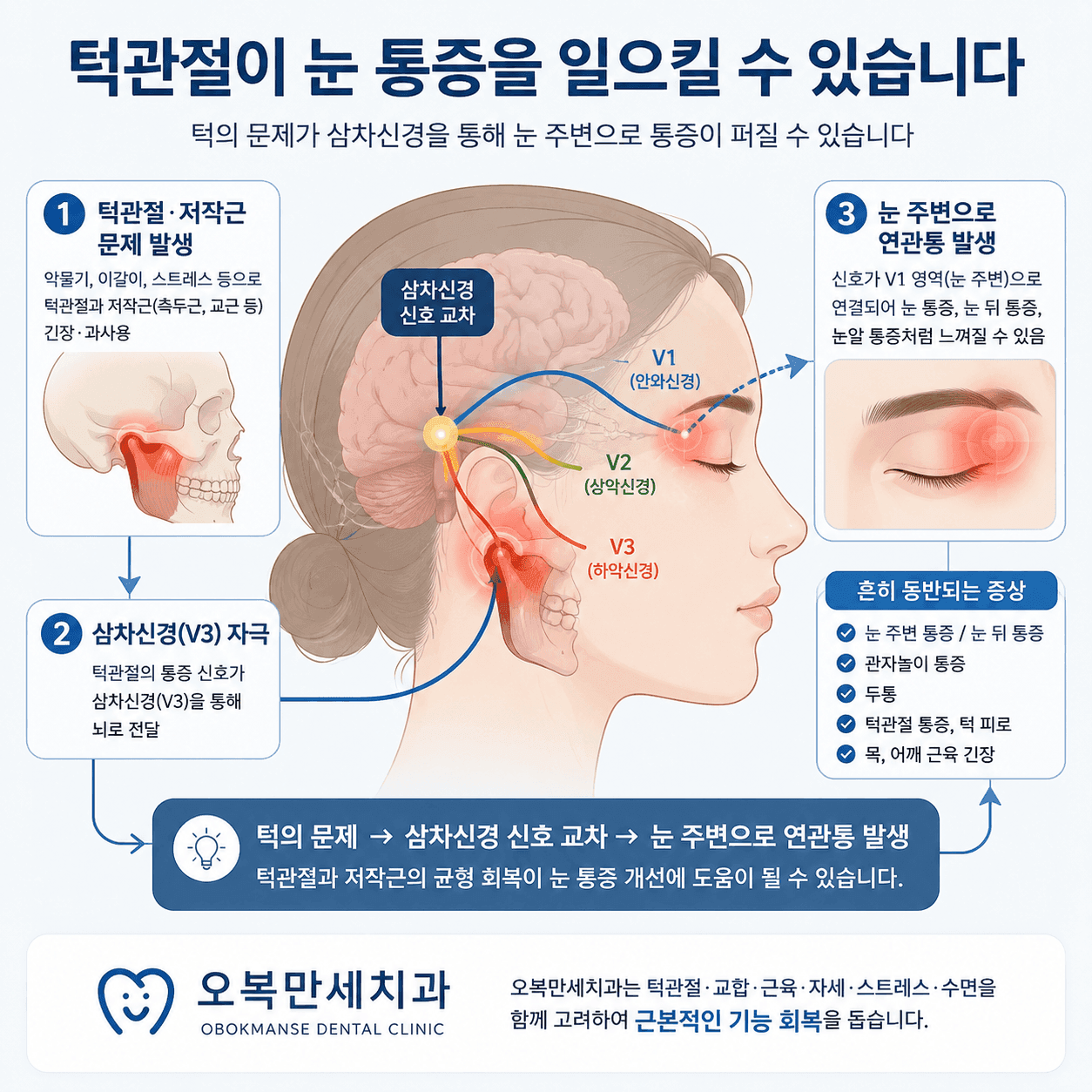 눈 열감과 눈 통증, 턱관절, 저작근과 관자놀이 긴장의 관계를 설명하는 개념 이미지