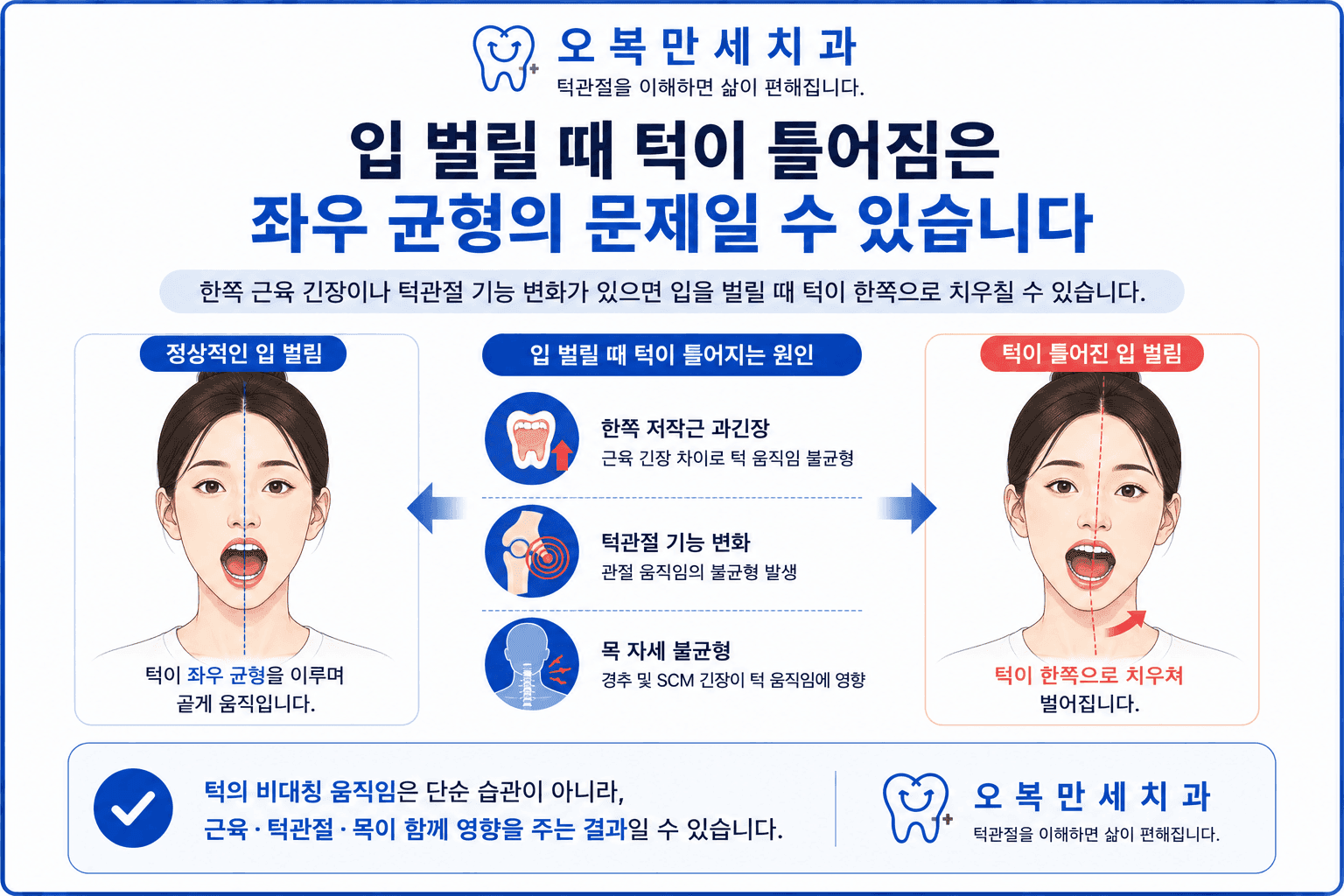 입을 벌릴 때 턱이 한쪽으로 틀어지는 경우 좌우 움직임과 함께 확인할 내용을 설명하는 인포그래픽