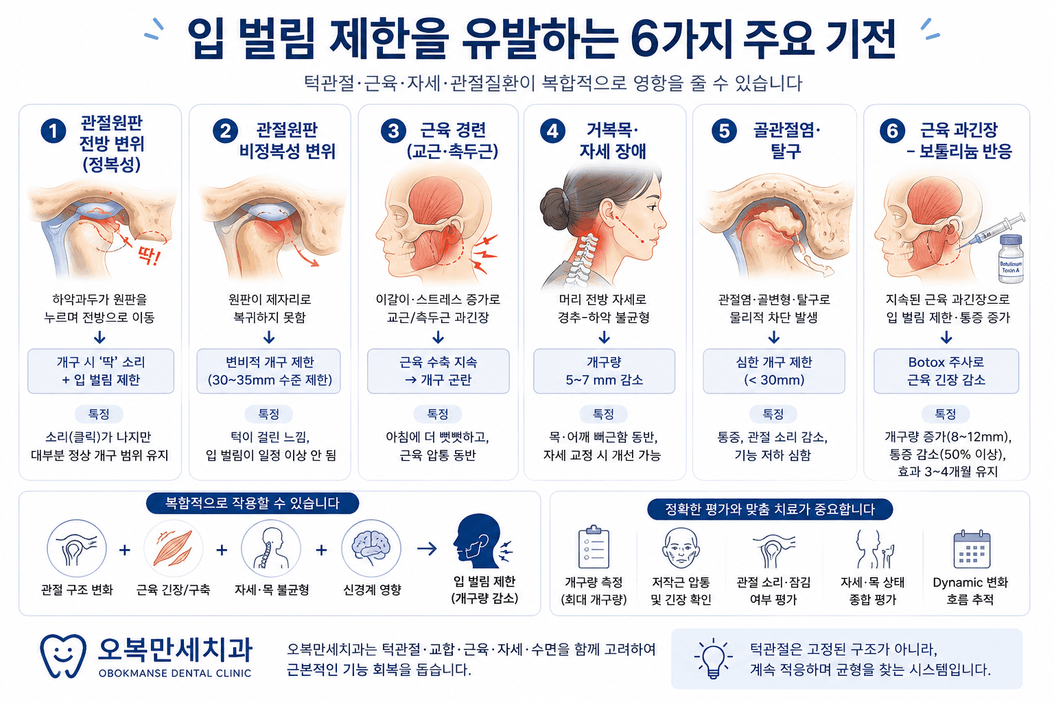 입을 크게 벌렸다 다물 때 턱이 걸리고 닫히지 않는 증상을 설명하는 턱관절 의료 그림