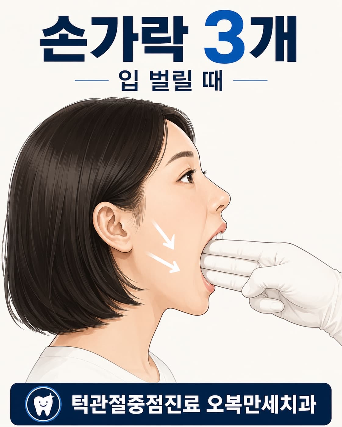 입을 벌렸을 때 위아래 앞니 사이에 손가락 3개가 세로로 들어가는지 확인하는 모습