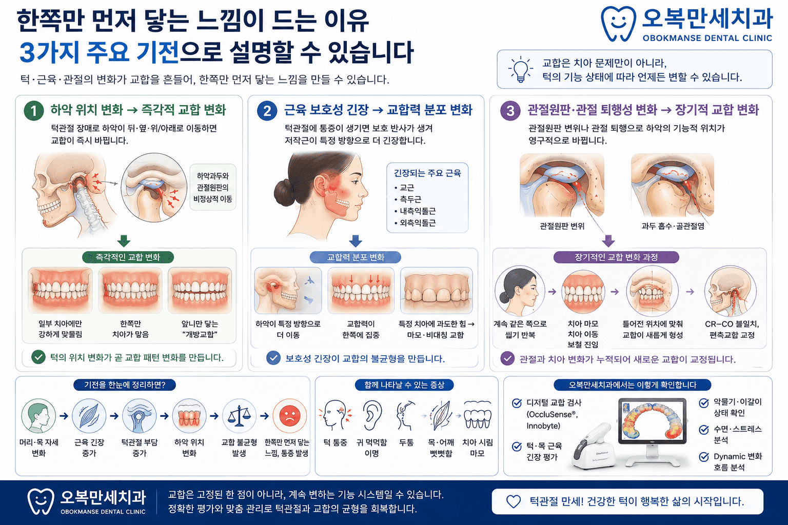 턱 위치와 근육 긴장 및 관절 상태의 변화로 한쪽 치아만 먼저 닿거나 뜬 느낌이 생길 수 있는 이유를 설명한 그림