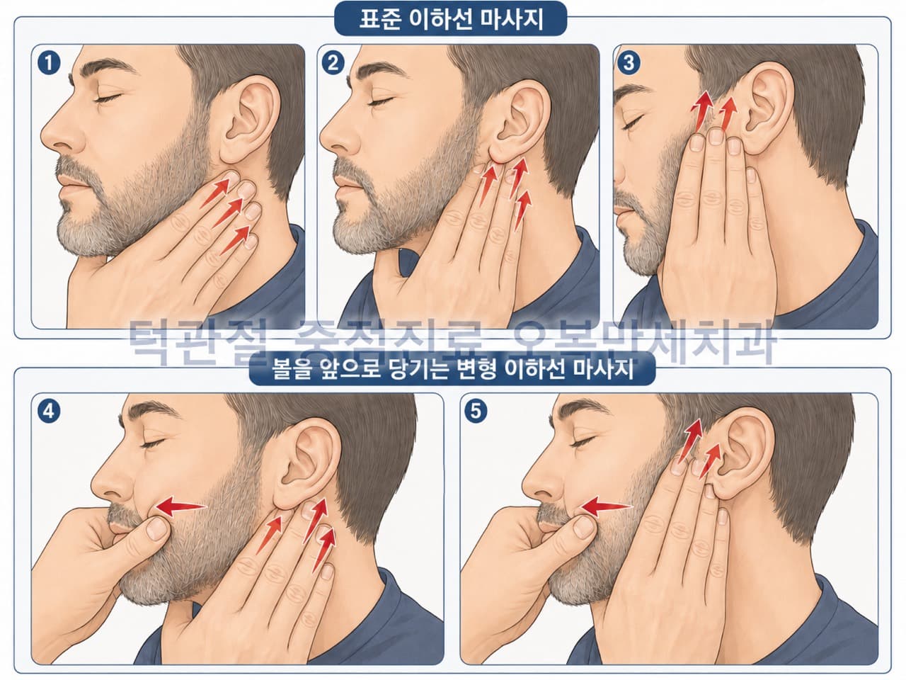 귀 앞과 귀밑의 이하선을 입안 방향으로 부드럽게 마사지하는 방법과 볼을 앞쪽으로 당겨 시행하는 변형 방법을 설명한 그림