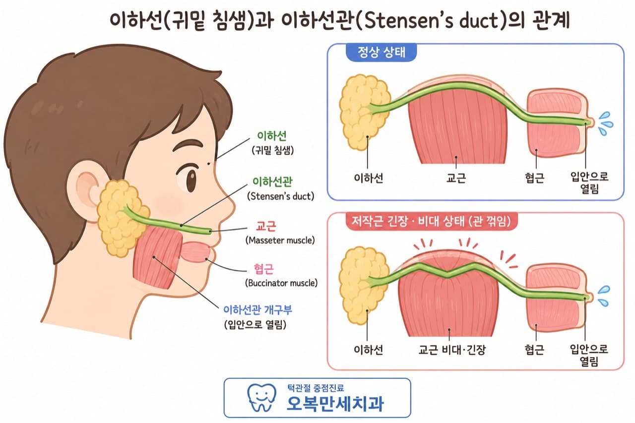 이하선과 이하선관, 교근, 협근의 관계와 저작근 긴장 상태에서 관이 꺾일 수 있는 구조를 설명하는 그림