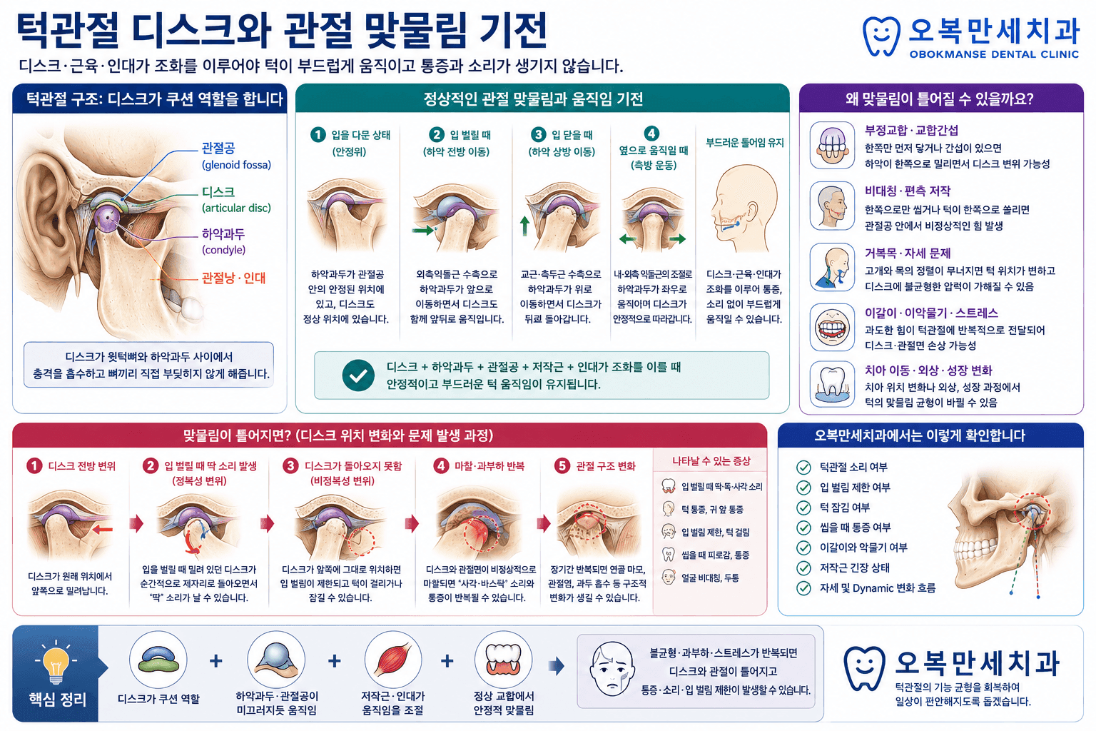 턱관절 디스크와 과두 및 관절 뒤쪽 조직의 위치를 설명하는 의료 그림