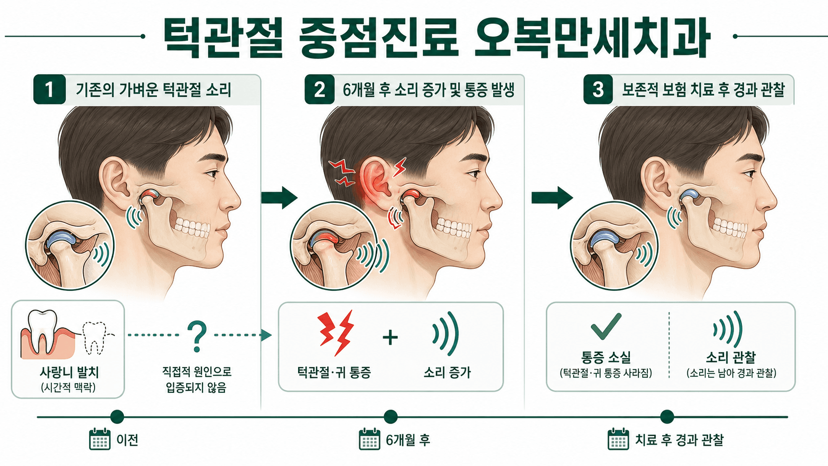 사랑니 발치 전후 턱관절 소리와 오른쪽 귀 통증, 보존적 치료 후 통증 소실과 관절음 관찰 과정을 설명한 오복만세치과 인포그래픽