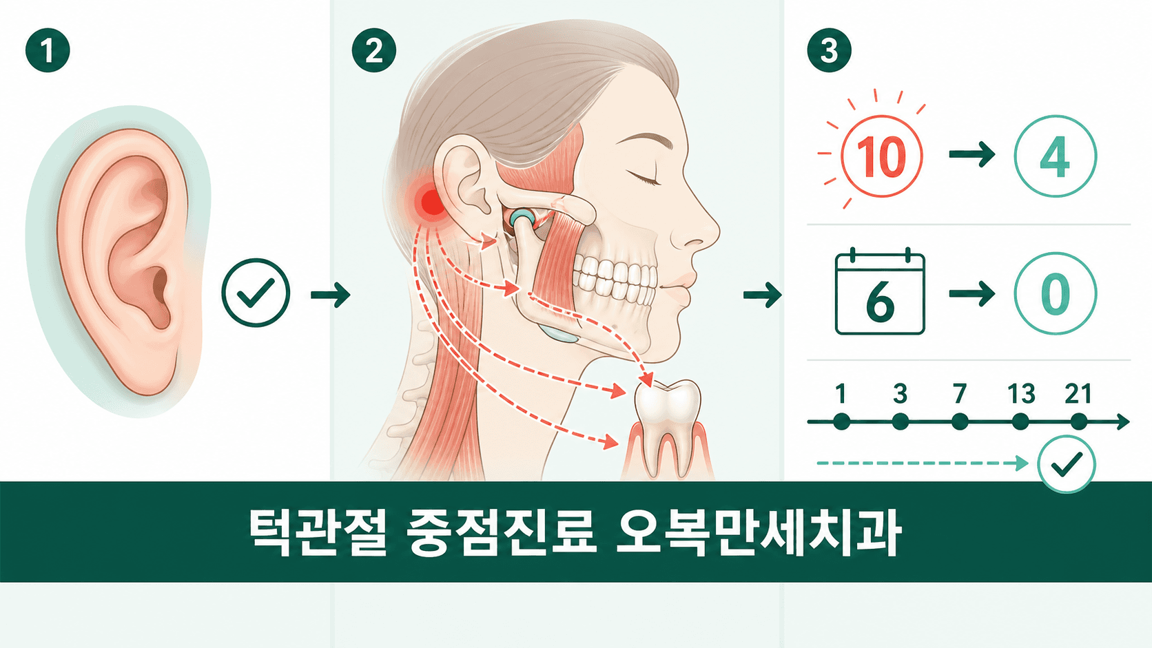 이비인후과 검사에서 이상이 없었던 귀 뒤 통증과 턱관절·목·아래 치아 연관통 가능성, 첫 치료 60퍼센트 감소 및 21주 경과를 설명한 오복만세치과 인포그래픽