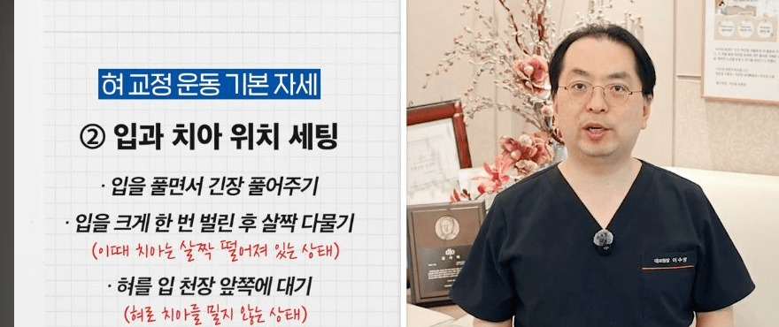 이원장이 치아는 살짝 떨어뜨리고 혀는 앞니를 밀지 않게 입천장 쪽에 두는 기본 자세를 설명하는 영상 장면