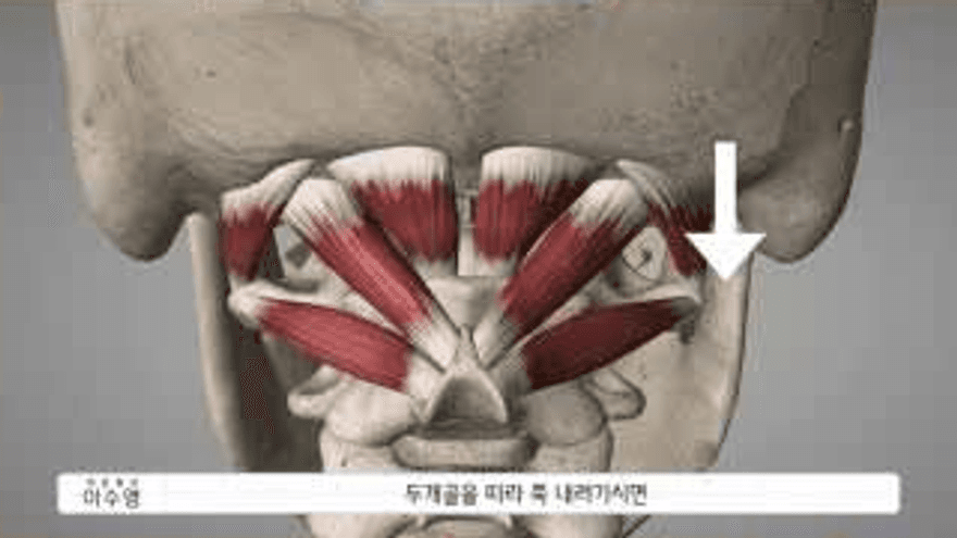 두개골 아래 후두하근의 위치를 보여주는 영상 해부 그림