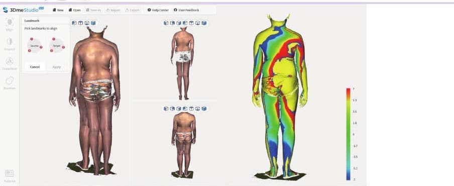 치료 전후 3차원 전신 표면 스캔을 겹쳐 경추와 골반 주변의 색상 편차를 비교한 논문 그림