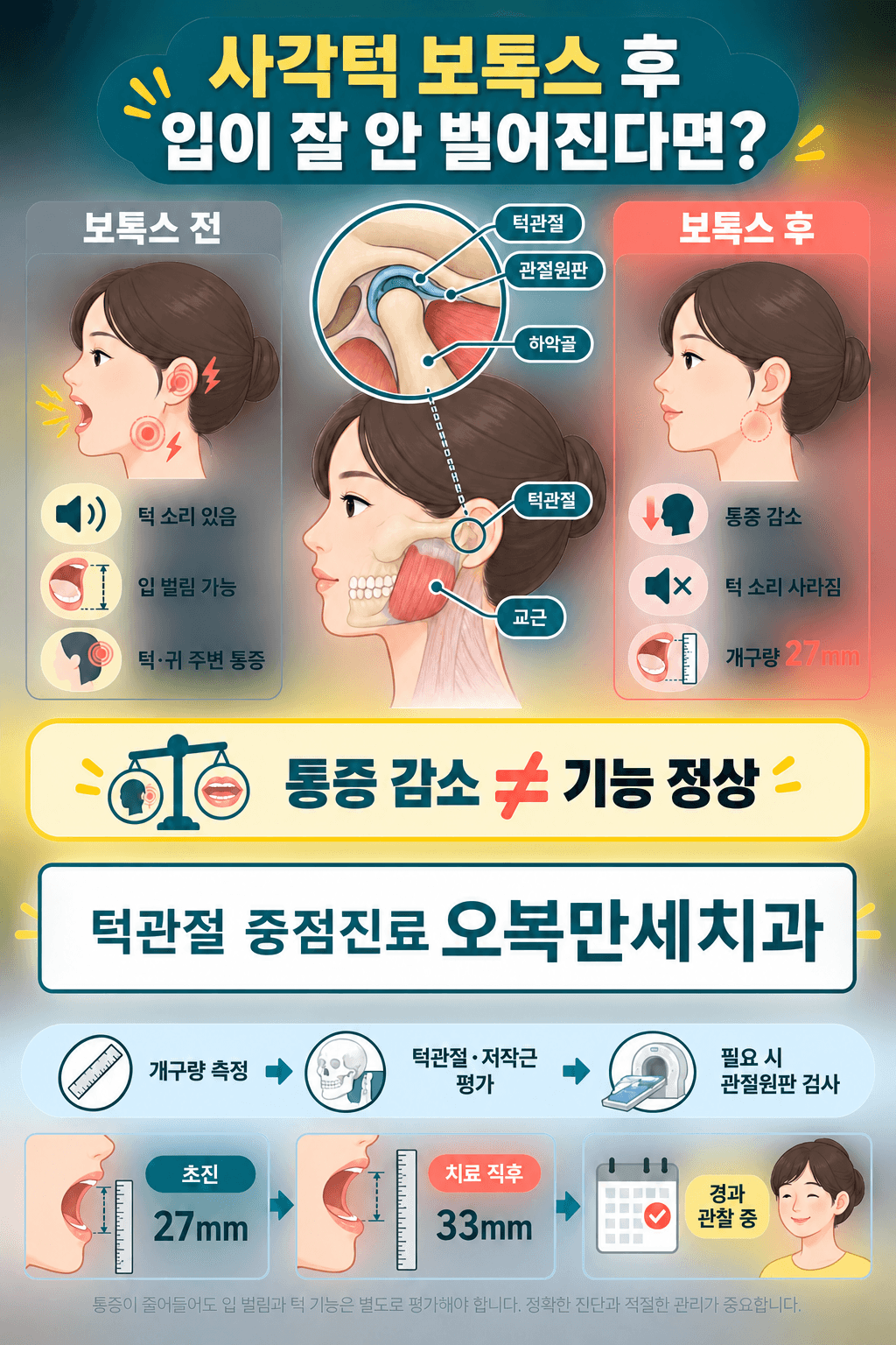 사각턱 보톡스 전후 턱과 귀 주변 통증, 턱 소리, 개구량 변화를 비교하고 턱관절과 저작근 평가 순서를 설명하는 의료 일러스트