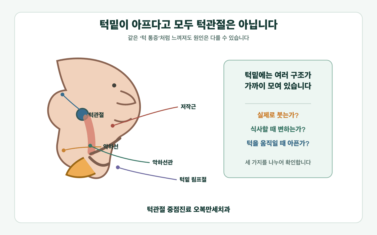 턱밑 통증 주변의 악하선, 악하선관, 턱관절, 저작근과 림프절 위치를 비교한 의료 일러스트