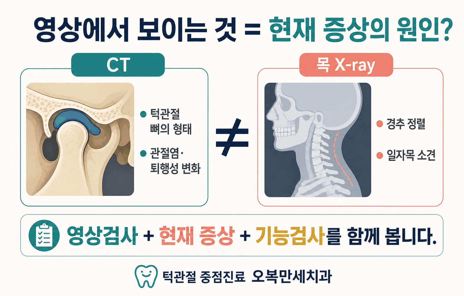 턱관절 CT와 목 X-ray 소견만으로 현재 턱 잠김의 원인을 확정할 수 없음을 설명한 그림