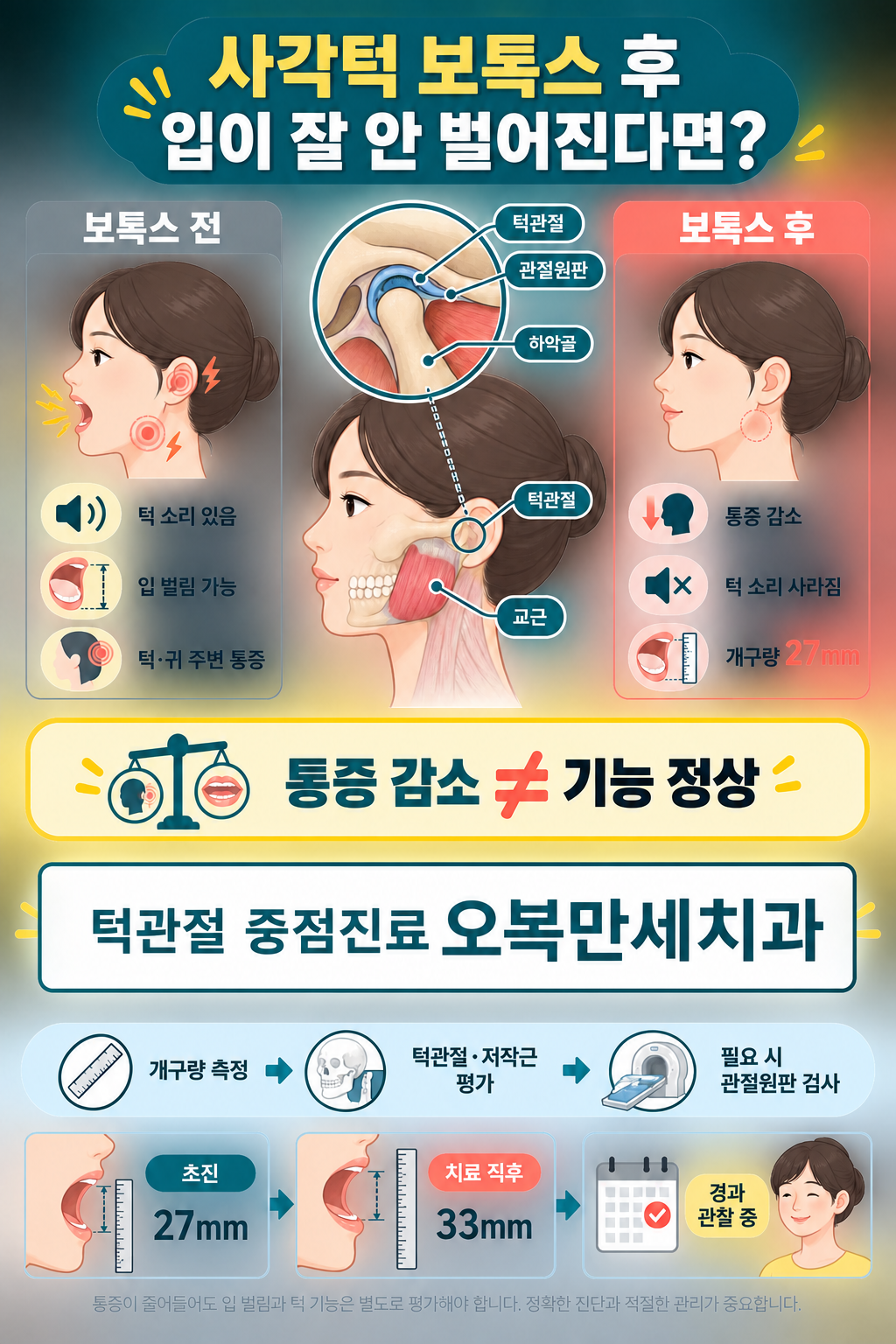사각턱 보톡스 전후 턱과 귀 주변 통증, 턱 소리, 개구량 변화를 비교하고 턱관절과 저작근 평가 순서를 설명하는 의료 일러스트