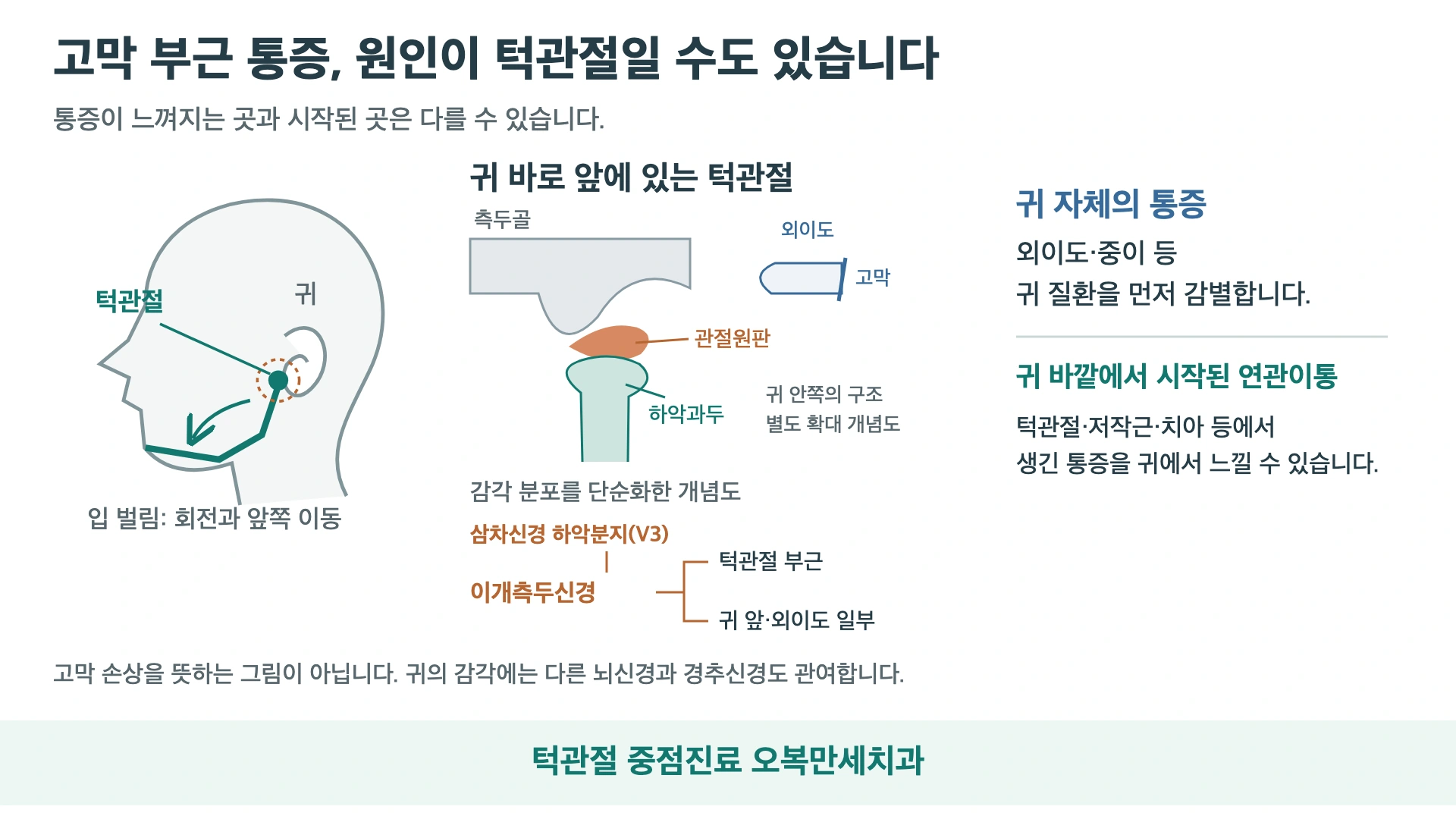 귀 앞의 턱관절과 외이도·고막의 위치, 이개측두신경의 감각 분포를 단순화해 연관이통을 설명한 도식
